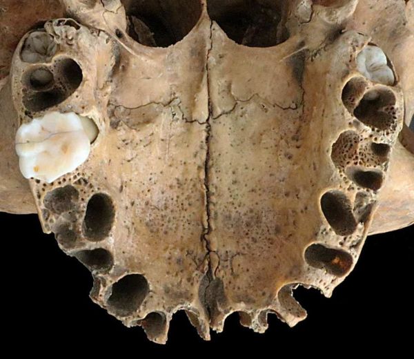 Documentado caso mais antigo de mutilação facial como castigo na Inglaterra anglo-saxã (FOTOS) Documentado caso mais antigo de mutilação facial como castigo na Inglaterra anglo-saxã (FOTOS) - Sputnik Brasil
