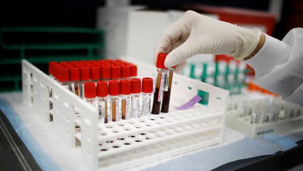 Tubos de ensaio com amostras de plasma e sangue para estudo de vacinação - Sputnik Brasil