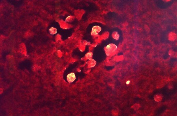 Ameba 'comedora de cérebros' avança para norte e deixa EUA em alerta - Sputnik Brasil