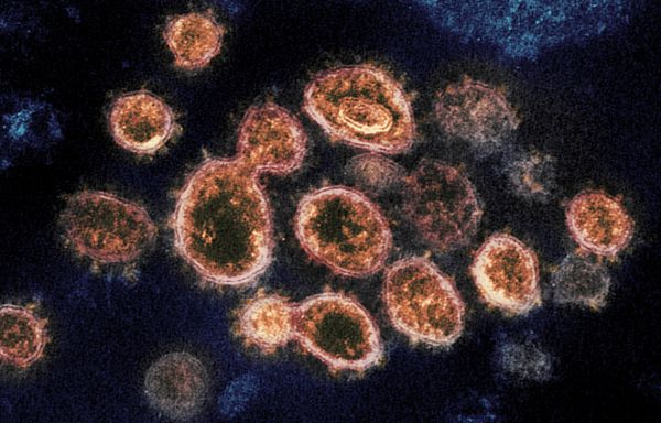 Geneticista fala sobre estudo que identificou nova variante do coronavírus no estado do RJ Geneticista fala sobre estudo que identificou nova variante do coronavírus no estado do RJ - Sputnik Brasil