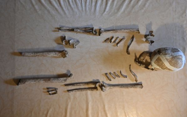 Esqueleto de 5.000 anos encontrado na Alemanha fornece pistas sobre era pré-histórica (FOTO) Esqueleto de 5.000 anos encontrado na Alemanha fornece pistas sobre era pré-histórica (FOTO) - Sputnik Brasil