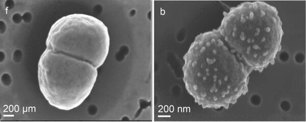 Esta bactéria 'imortal' sobreviveu um ano inteiro fora da EEI (FOTOS) Esta bactéria 'imortal' sobreviveu um ano inteiro fora da EEI (FOTOS) - Sputnik Brasil