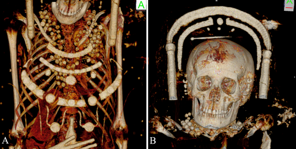 Arqueólogos finalmente 'desbravam' interior de múmias egípcias encontradas em 1615 (FOTOS) - Sputnik Brasil