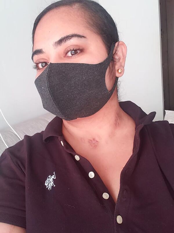 Médica colombiana diz que teve de reaprender a falar e escrever após COVID-19 - Sputnik Brasil