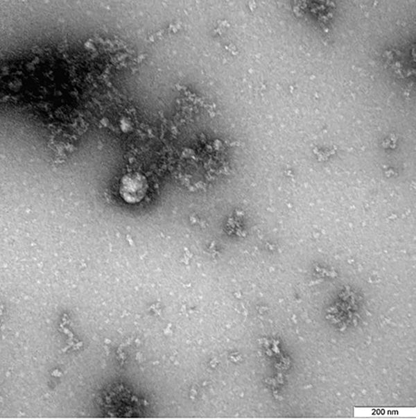 Cientistas russos revelam a 1ª FOTO da cepa britânica da COVID-19 Cientistas russos revelam a 1ª FOTO da cepa britânica da COVID-19 - Sputnik Brasil