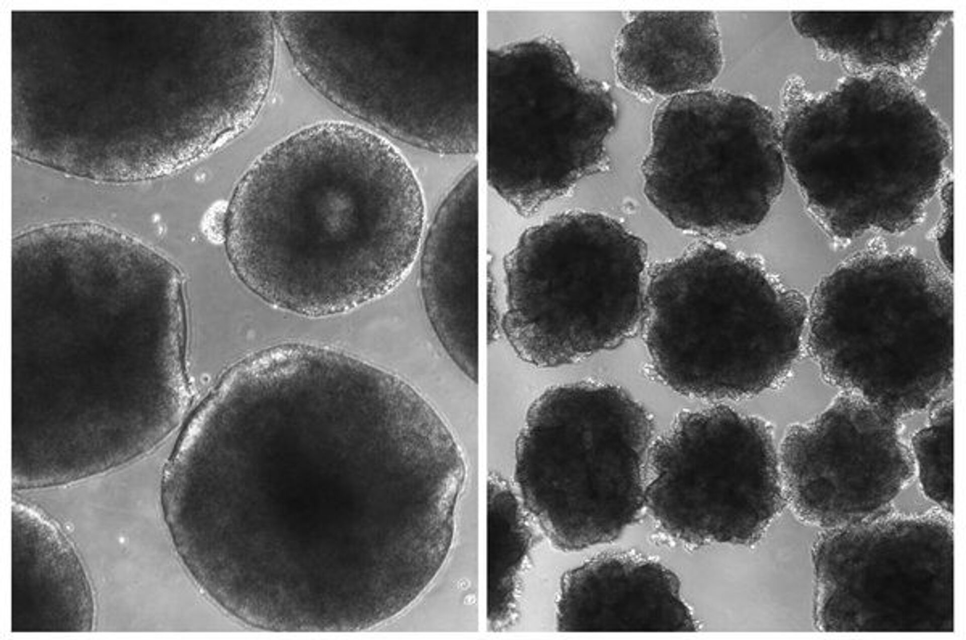 Minicérebros dotados de gene neandertal oferecem pista sobre a evolução humana - Sputnik Brasil, 1920, 13.02.2021