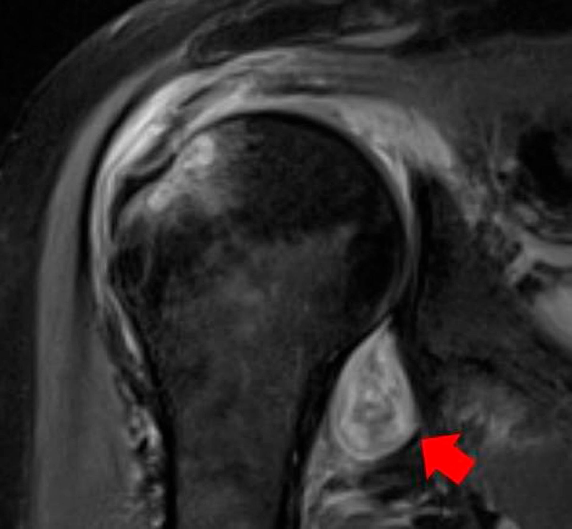 Cientistas explicam causa de dores estranhas no corpo causadas por COVID-19 (FOTO) - Sputnik Brasil, 1920, 17.02.2021