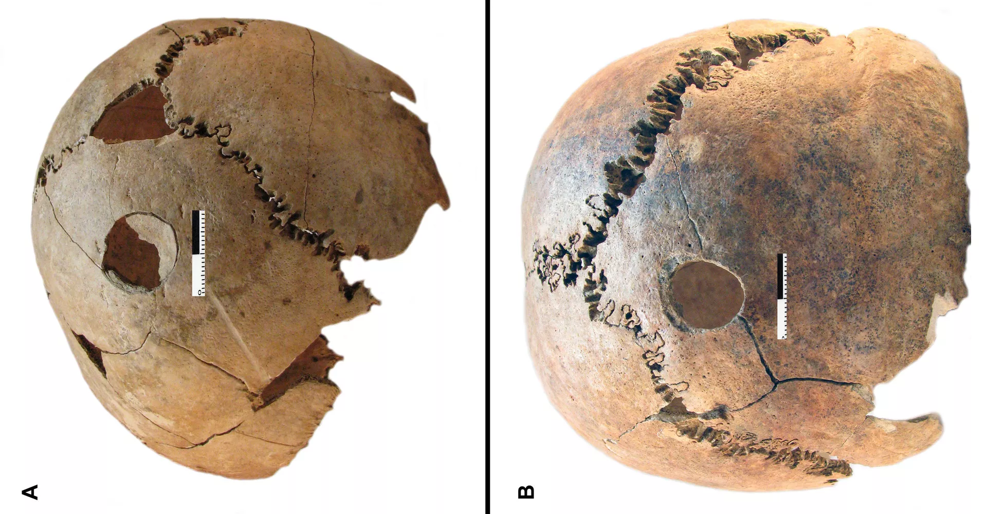 Enterro coletivo de 6.200 anos revela vestígios de massacre sem explicação (FOTOS) Enterro coletivo de 6.200 anos revela vestígios de massacre sem explicação (FOTOS) - Sputnik Brasil, 1920, 12.03.2021