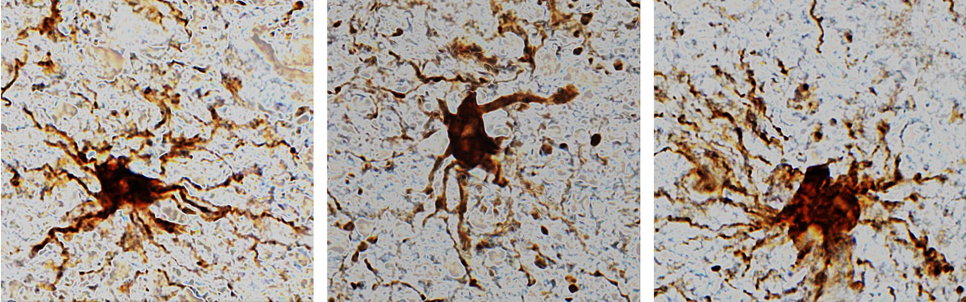 Descobertas no cérebro 'células zumbis' que aumentam sua atividade após morte (FOTO) - Sputnik Brasil, 1920, 24.03.2021