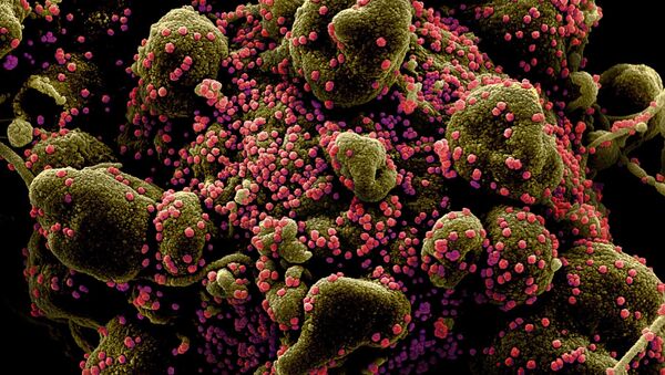 Imagem colorida de microscópio eletrônico de varredura mostra uma célula fortemente infectada com partículas do SARS-CoV-2, também conhecido como novo coronavírus - Sputnik Brasil