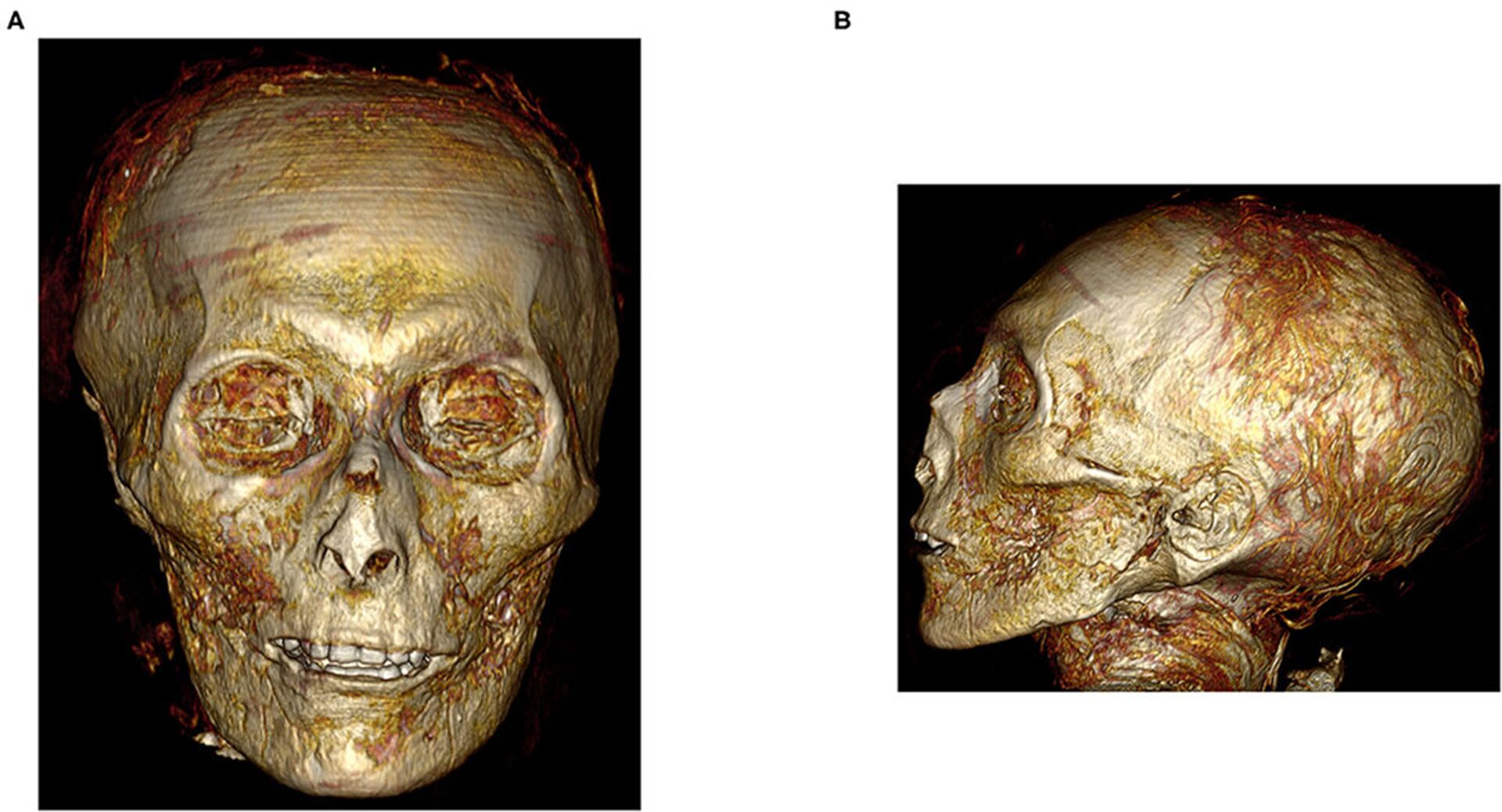 Imagem tridimensional de TC do rosto digitalmente desembrulhado da múmia Amenhotep I - Sputnik Brasil, 1920, 28.12.2021