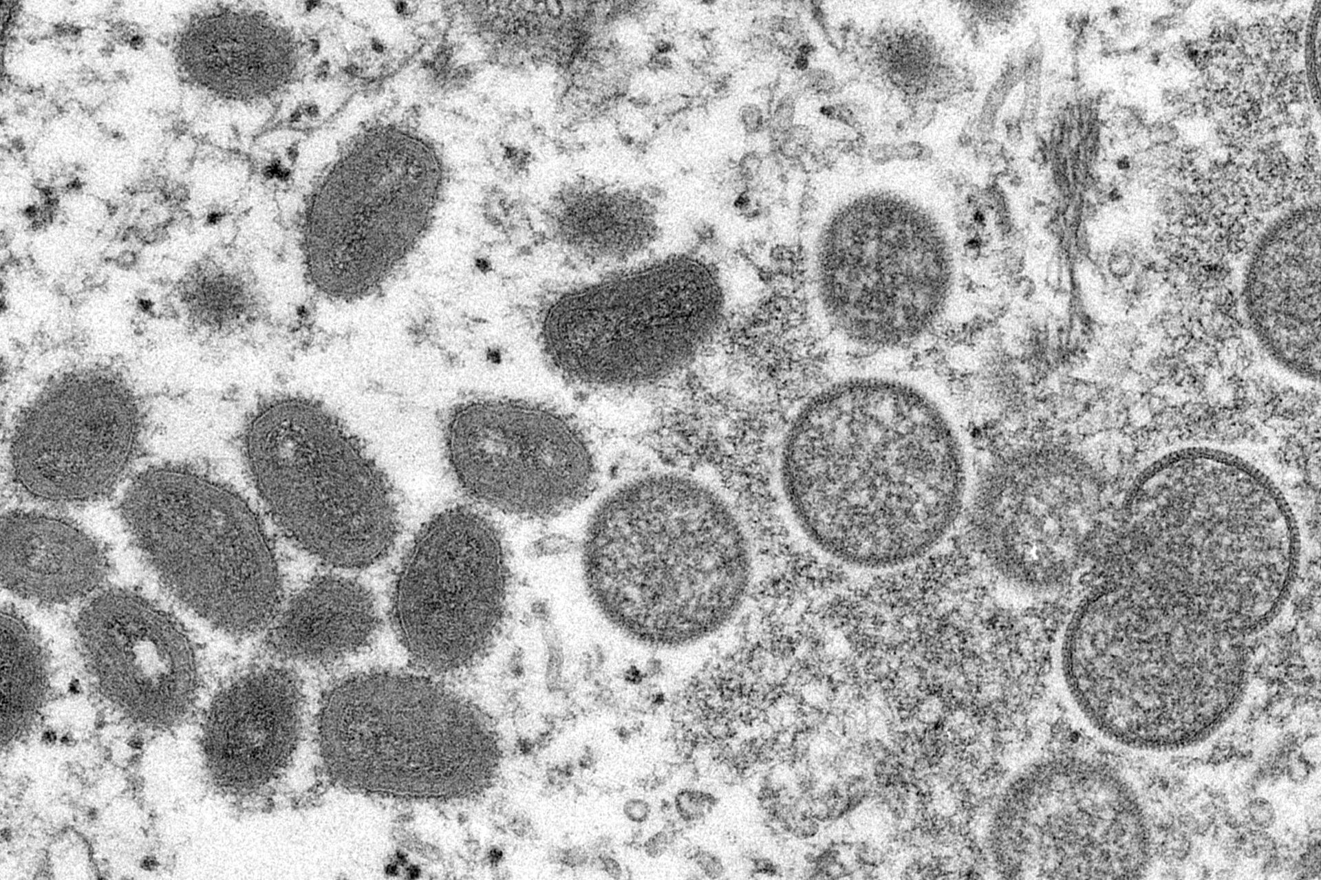 Esta imagem de microscópio eletrônico disponibilizada pelos Centros de Controle e Prevenção de Doenças mostra vírions de varíola dos macacos maduros e ovais, à esquerda, e vírions imaturos esféricos, à direita, obtidos de uma amostra de pele humana associada ao surto de cães da pradaria de 2003 - Sputnik Brasil, 1920, 08.06.2022