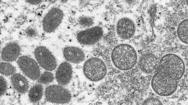 Esta imagem de microscópio eletrônico disponibilizada pelos Centros de Controle e Prevenção de Doenças mostra vírions de varíola dos macacos maduros e ovais, à esquerda, e vírions imaturos esféricos, à direita, obtidos de uma amostra de pele humana associada ao surto de cães da pradaria de 2003 - Sputnik Brasil