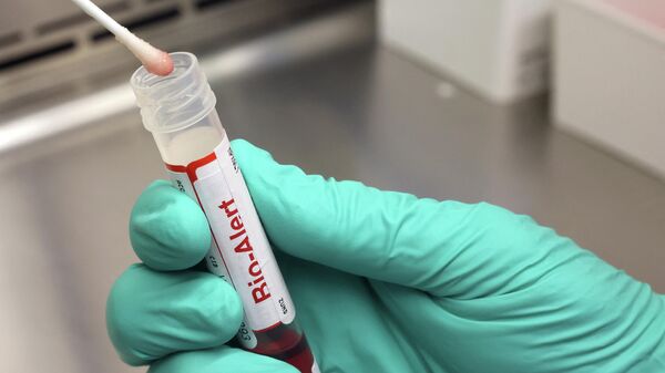 Um cotonete que testou positivo para o vírus da varíola dos macacos, ou monkeypox, no Laboratório de Virologia de Medicina da Universidade de Washington, em Seattle, Washington, 12 de julho de 2022 - Sputnik Brasil