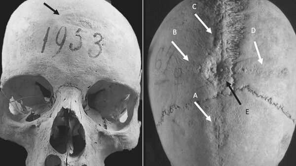 Processo de moldagem e fundição no crânio CT1953.  - Sputnik Brasil