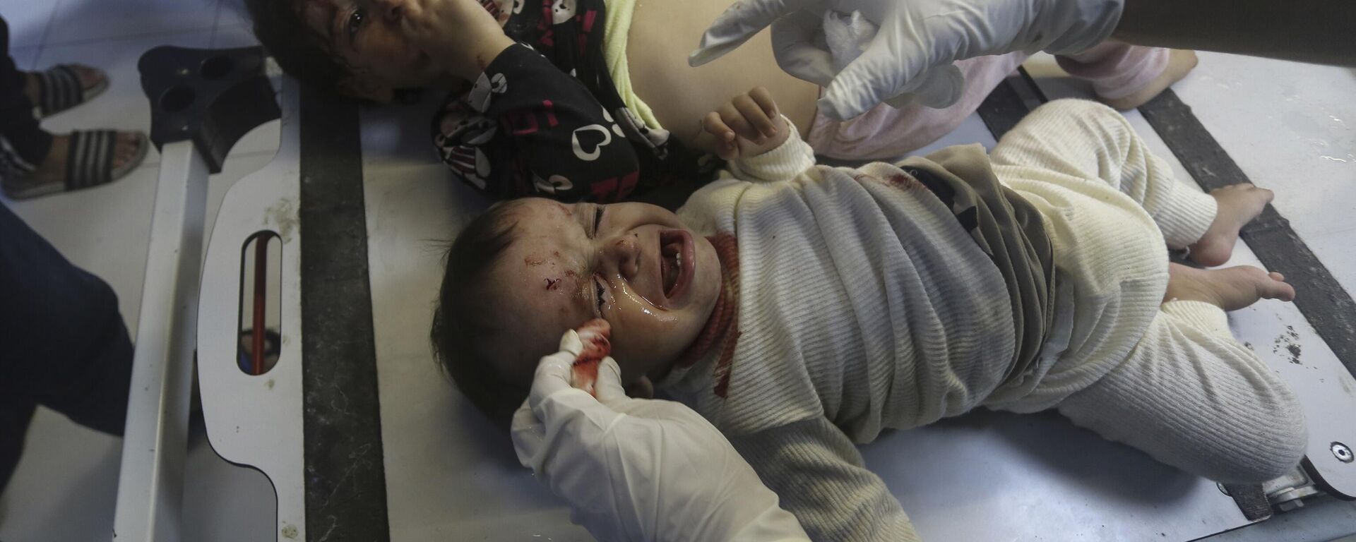 Crianças palestinas recebem tratamento em hospital de Gaza após ataque aéreo israelense. Faixa de Gaza, 23 de outubro de 2023 - Sputnik Brasil, 1920, 23.10.2023