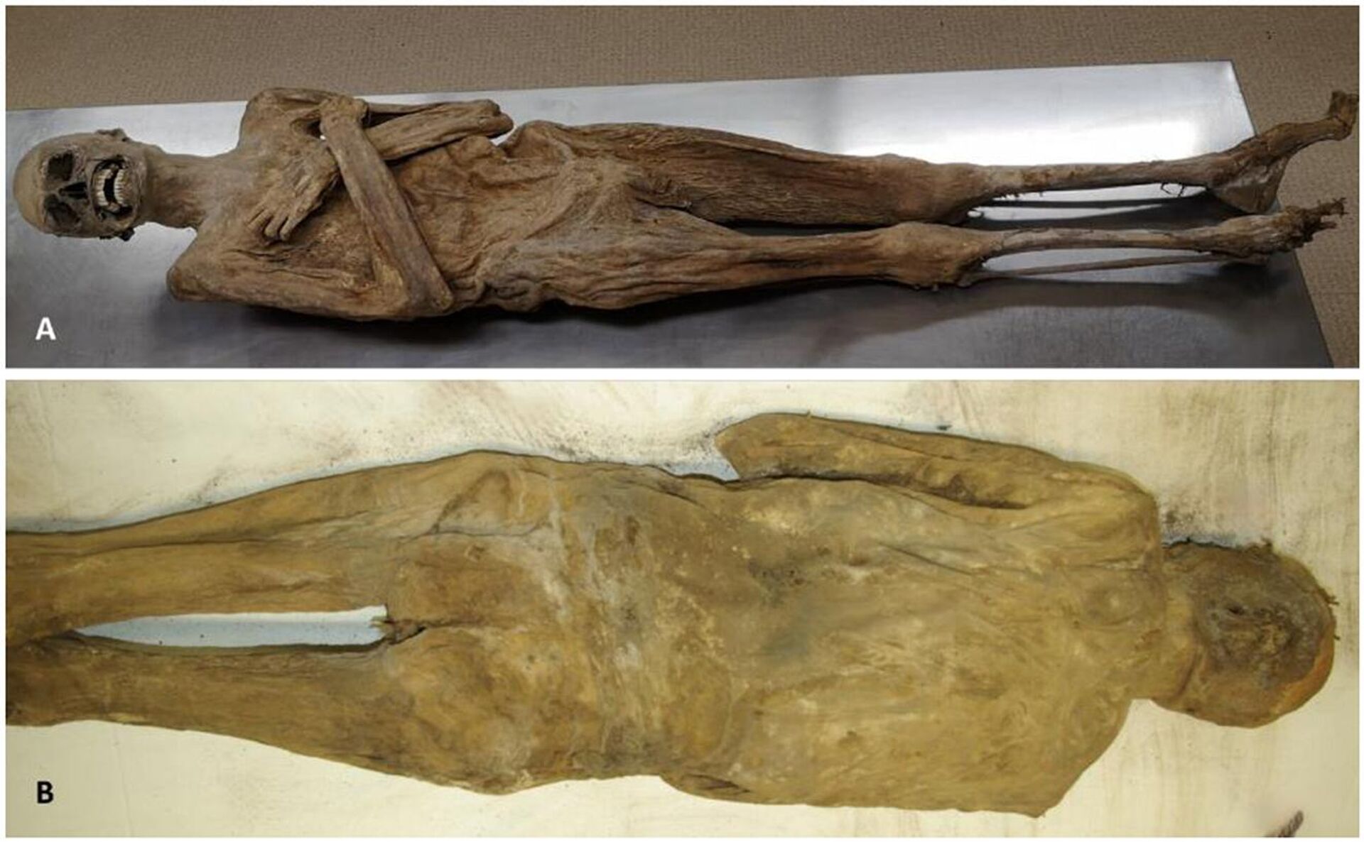 Aspecto externo da múmia, do lado ventral (A) e dorsal (B), mostrando a parede corporal completamente intacta Aspecto externo da múmia, do lado ventral (A) e dorsal (B), mostrando a parede corporal completamente intacta