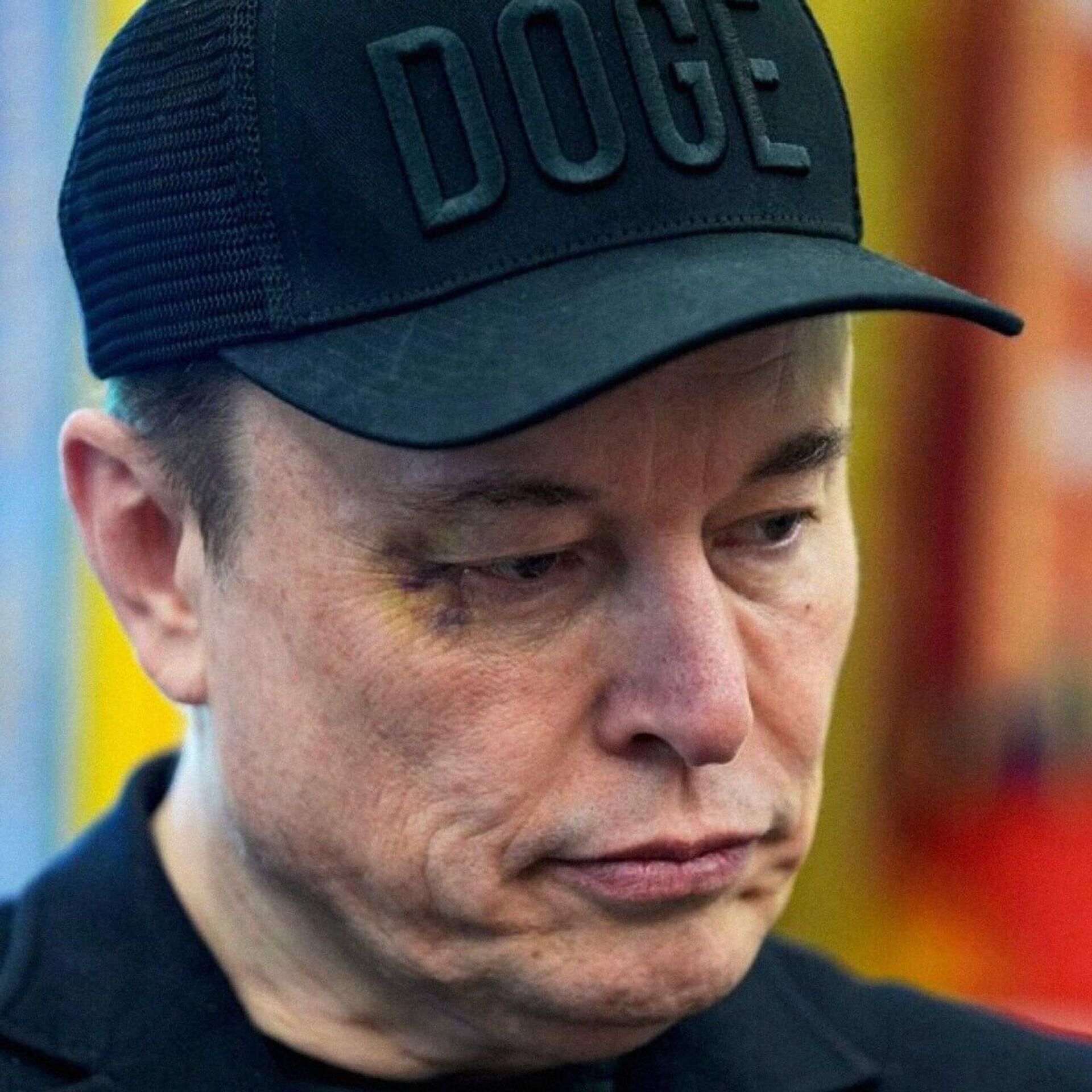 Musk aparece com hematoma no olho em cerimônia com Trump na Casa Branca Musk aparece com hematoma no olho em cerimônia com Trump na Casa Branca