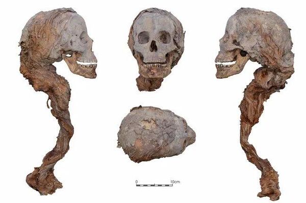 Cabeça parcialmente mumificada de uma mulher do século XIV encontrada em uma tumba outrora atribuída ao cavaleiro Artau de Foces, no Mosteiro de Pedralbes. Cabeça parcialmente mumificada de uma mulher do século XIV encontrada em uma tumba outrora atribuída ao cavaleiro Artau de Foces, no Mosteiro de Pedralbes. - Sputnik Brasil