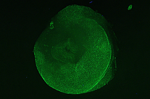 Imagem microscópica de pata tubular ambulacral removida, com coloração fluorescente - Sputnik Brasil