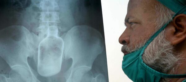 Médico observando raio X - Sputnik Brasil