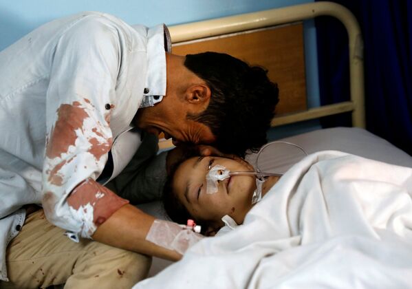 Um homem chora ao lado de uma menina ferida em um hospital depois de um ataque suicida em Cabul, no Afeganistão. - Sputnik Brasil