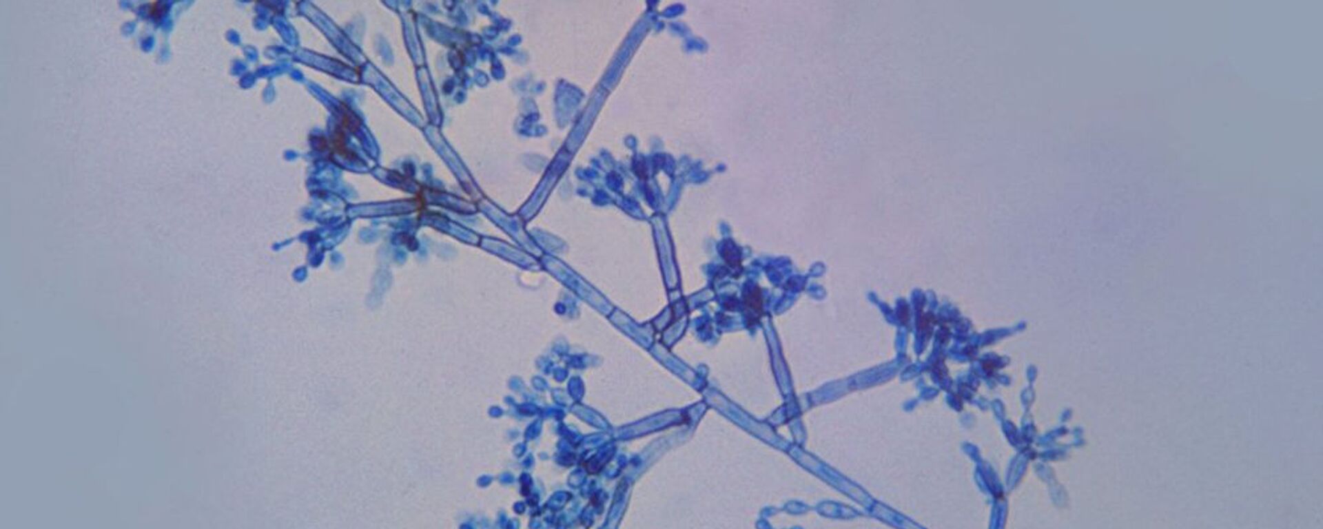 Fungos Chaetothyriales (imagem referencial) - Sputnik Brasil, 1920, 30.12.2021