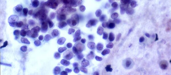 Células de câncer (imagem de arquivo) - Sputnik Brasil