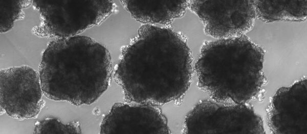 Imagem em microscópio do minicérebro criado por cientista brasileiro - Sputnik Brasil