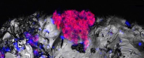 Micrografias fluorescentes mostrando presença de cianobactérias em amostras de rocha extraída de grande profundidade - Sputnik Brasil