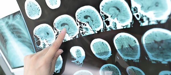 Tomografia de crânio humano - Sputnik Brasil