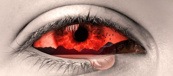 Olho sangrando (imagem referencial) Olho sangrando (imagem referencial) - Sputnik Brasil