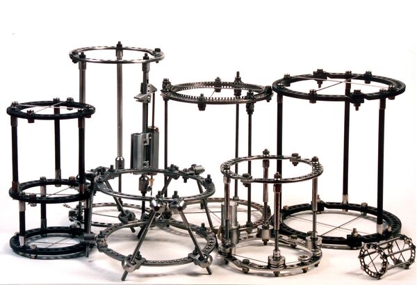 Aparatos Ilizárov - Sputnik Brasil