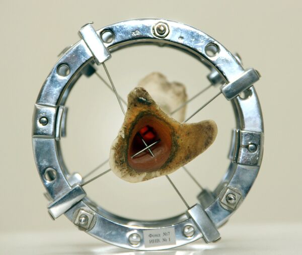 Aparelho Ilizarov - Sputnik Brasil