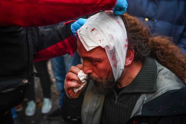 Kostis Dadamis, fotógrafo colaborador da Sputnik, após ser ferido em protesto realizado em Atenas. - Sputnik Brasil