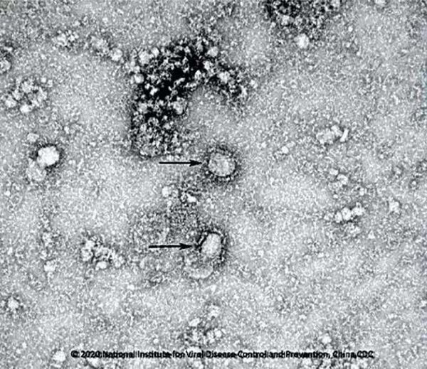 Primeira imagem do novo coronavírus detectado na China - Sputnik Brasil