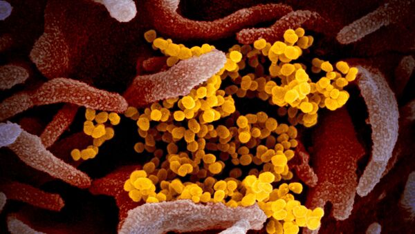 Imagem de microscópio eletrônico de varredura mostra SARS-CoV-2 na cor amarela - Sputnik Brasil