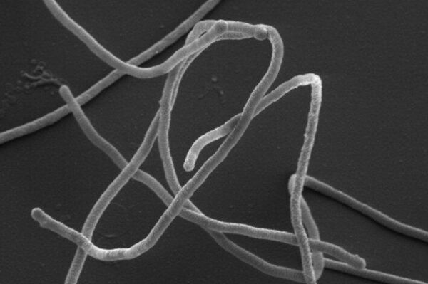 Achado 'elo perdido' bacteriano fundamental a pensamento e memória do ser humano - Sputnik Brasil