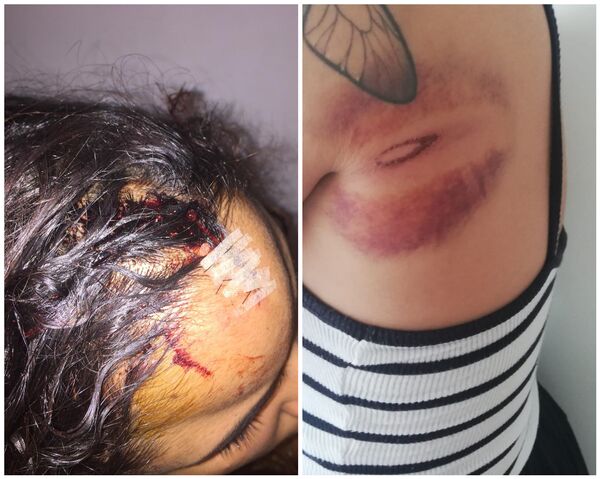 Violência policial contra brasileiras em Lisboa gera repercussão no parlamento português - Sputnik Brasil