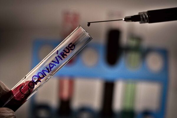 COVID-19: pesquisadores de Hong Kong relatam 1º caso documentado de reinfecção COVID-19: pesquisadores de Hong Kong relatam 1º caso documentado de reinfecção - Sputnik Brasil