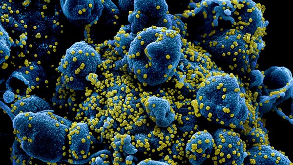Micrografia eletrônica digitalmente colorida de uma célula apoptótica (azul) altamente infectada com partículas do vírus SARS-CoV-2 (amarelo), isolada a partir de amostra obtida de um doente. Imagem capturada e colorida pelo NIAID Integrated Research Facility (IRF) em Fort Detrick, Maryland, EUA - Sputnik Brasil