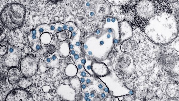 Imagem microscópica eletrônica fluorescente do primeiro caso americano de COVID-19, anteriormente conhecido como 2019-nCoV. As partículas virais esféricas, de cor azul, contêm seções transversais do genoma viral, visíveis como pontos pretos - Sputnik Brasil