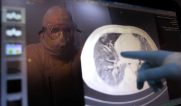 'Não temos que roubar': vacina de Oxford está sendo compartilhada com Rússia, diz diretor do RFPI - Sputnik Brasil