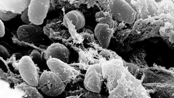 Bactérias Yersinia pestis, causadora da peste bubônica - Sputnik Brasil
