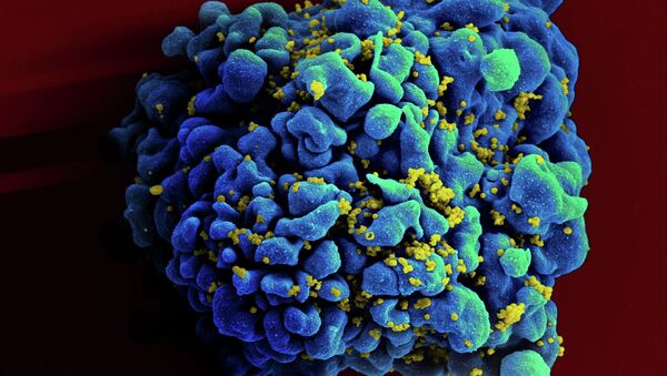 Célula infectada pelo HIV. - Sputnik Brasil