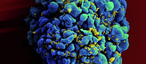 célula infetada com HIV - Sputnik Brasil