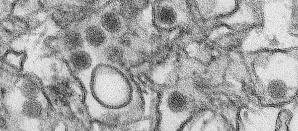 Zika Vírus - Sputnik Brasil