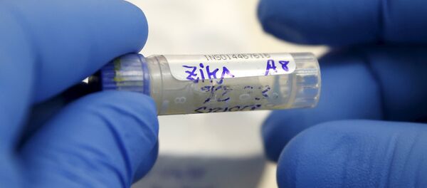 Agente de saúde analisa amostra de sangue de paciente com suspeitas de zika no Instituto Nacional de Saúde de Lima, Peru, em 2 de fevereiro de 2016 - Sputnik Brasil