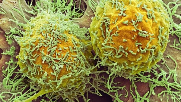Células de câncer no fígado - Sputnik Brasil