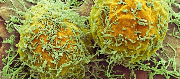 Células de câncer no fígado - Sputnik Brasil